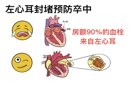 70ad89fcc390137a04cf6020d08c800.png